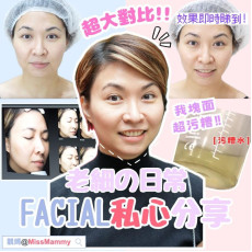 ♡靚媽Hifu facial三步曲♡