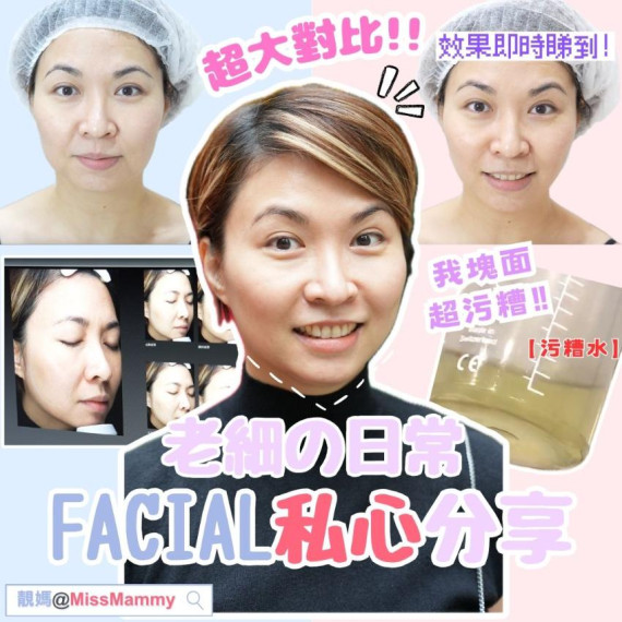 ♡靚媽Hifu facial三步曲♡